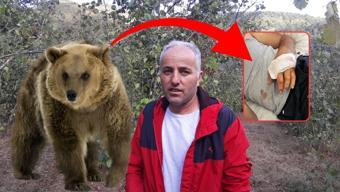 Bolu’da ayıyla boğuşup hayatta kalan kişi yaşananları anlattı: 'Hortumu boğazına soktum, bıraktı'