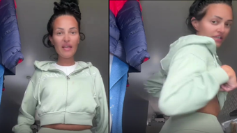 Mide küçültme ameliyatı hayatını kararttı! Genç kadın otururken bile acı çekiyor