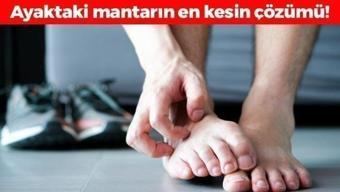 Ayak mantarının kökünü kurutuyor! Egzama, mantar ve kuruluğa iyi geliyor, cildi neme doyurup 5 dakikada ayakları bebek gibi yumuşacık yapıyor!