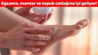 Ayaktaki mantar, egzama ve topuk çatlaklarının kökünü kurutuyor! Her evde olan malzemeleri kullanmak yetiyor