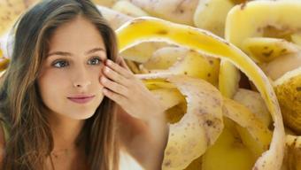 Patatesi yiyip kabuğunu sakın çöpe atmayın! Kolajen üretimini artırıp göz altı halkalarını silgi gibi siliyor, 10 dakika uygulamak yetiyor cildi ışıl ışıl yapıyor!