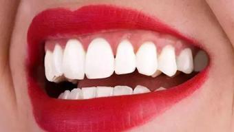 Diş sağlığını korumanın doğal yöntemleri