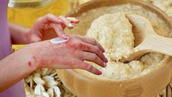 Banyonuza yulaf ezmesi ekleyin! Egzamayı ve mantarı dindirmeye yardımcı oluyor