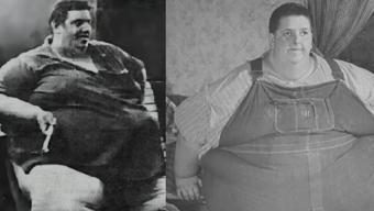 Tarihe geçen ağırlık! Dünyanın en şişman insanı tam 408 kilo verdi: Bakın sonu ne oldu...