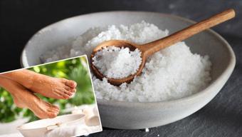 Taş gibi sert olan ayak derisinden kurtulun! Nasırı tarihe karıştırıyor, 3 doğal karışım önerisi