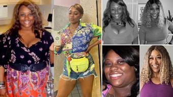 Genç kadın tam 46 kilo verdi! 109 kilodan 63 kiloya düştü, lise arkadaşları bile tanıyamıyor!