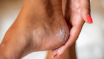 Topuk çatlağını pamuk gibi yapıyor! Ayakları yumuşatan ev yapımı reçete