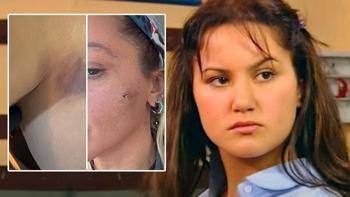 Yıldız Asyalı'ya ne oldu? Yıldız Asyalı'yı eşi darp mı etti, eşi Mustafa Semih Demirci kimdir? Yıldız Asyalı oynadığı dizi ve filmler