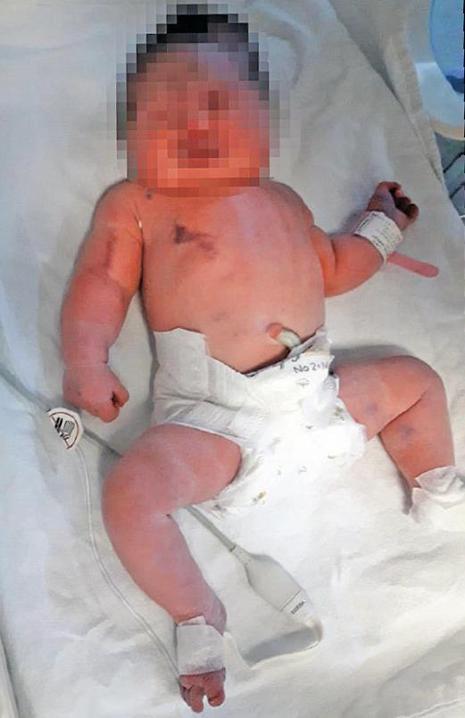 Korkunç ihmal Doğuma doktor girmedi, bebek sakat doğdu