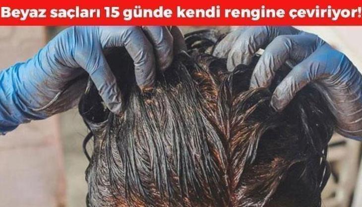 Beyaz saçları 15 günde kendi rengine çeviriyor! Saç boyasına son, beyaz saçlardan kurtulmak çok kolay