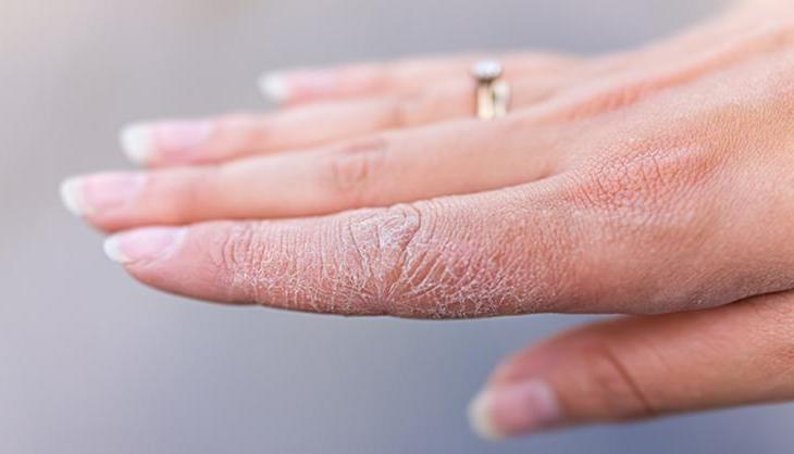 Kışın kuruyan ve çatlayan elleri bebek gibi yumuşacık yapan krem tarifi! 4 malzemeyle hazırlanıyor