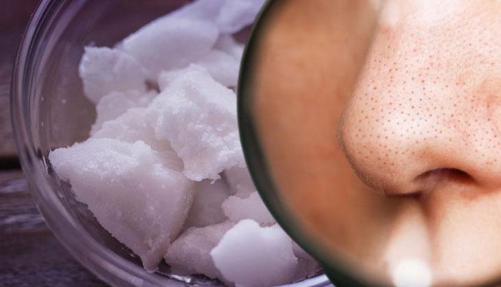 Siyah noktaları vakum gibi çeken ikili! Cildi derinlemesine arındırıyor