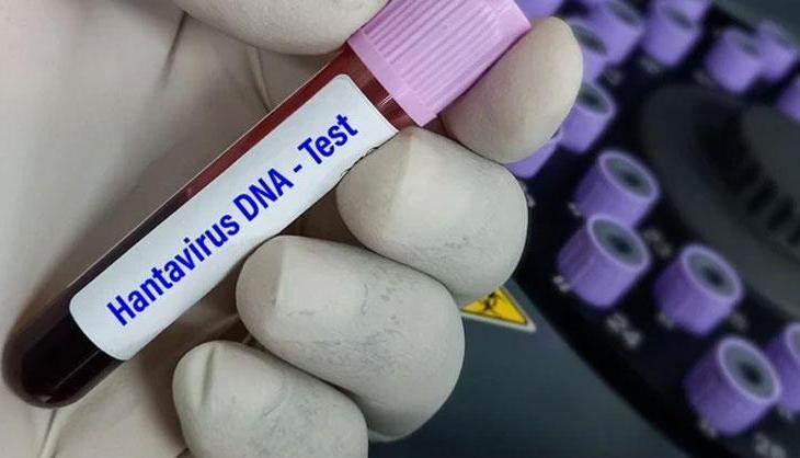 DSÖ'den hantavirüs açıklaması: Vaka sayısı artabilir