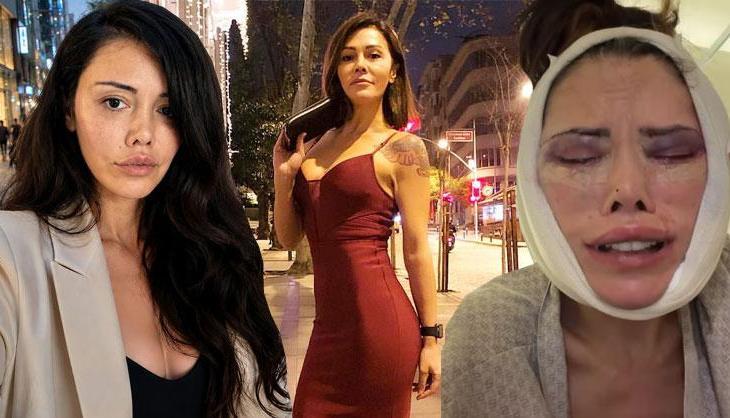 Yüz nakli sonrası bir ameliyat daha olmuştu! Didem Ceran yaşadıklarına isyan etti
