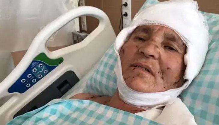 Köpek saldırısında yüzde 37 oranında malul kaldı! 637 bin liralık tazminat ödenecek