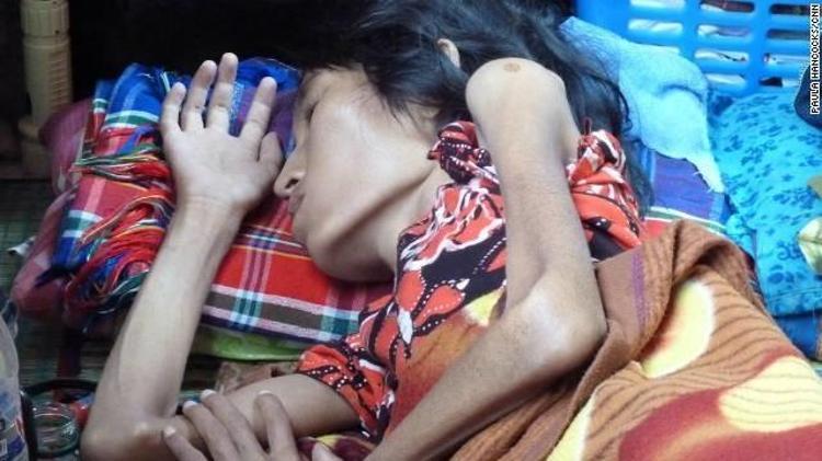 HIV tanısı nasıl koyulur