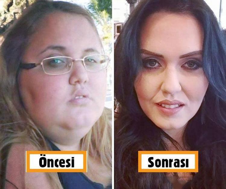 Лицо до и после похудения девушки. Похудение лица до и после фото. Лицо после похудения. Лицо до и после похудения. Лицо после похудения.