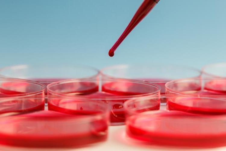 Anemi nedir Anemi belirtileri nelerdir