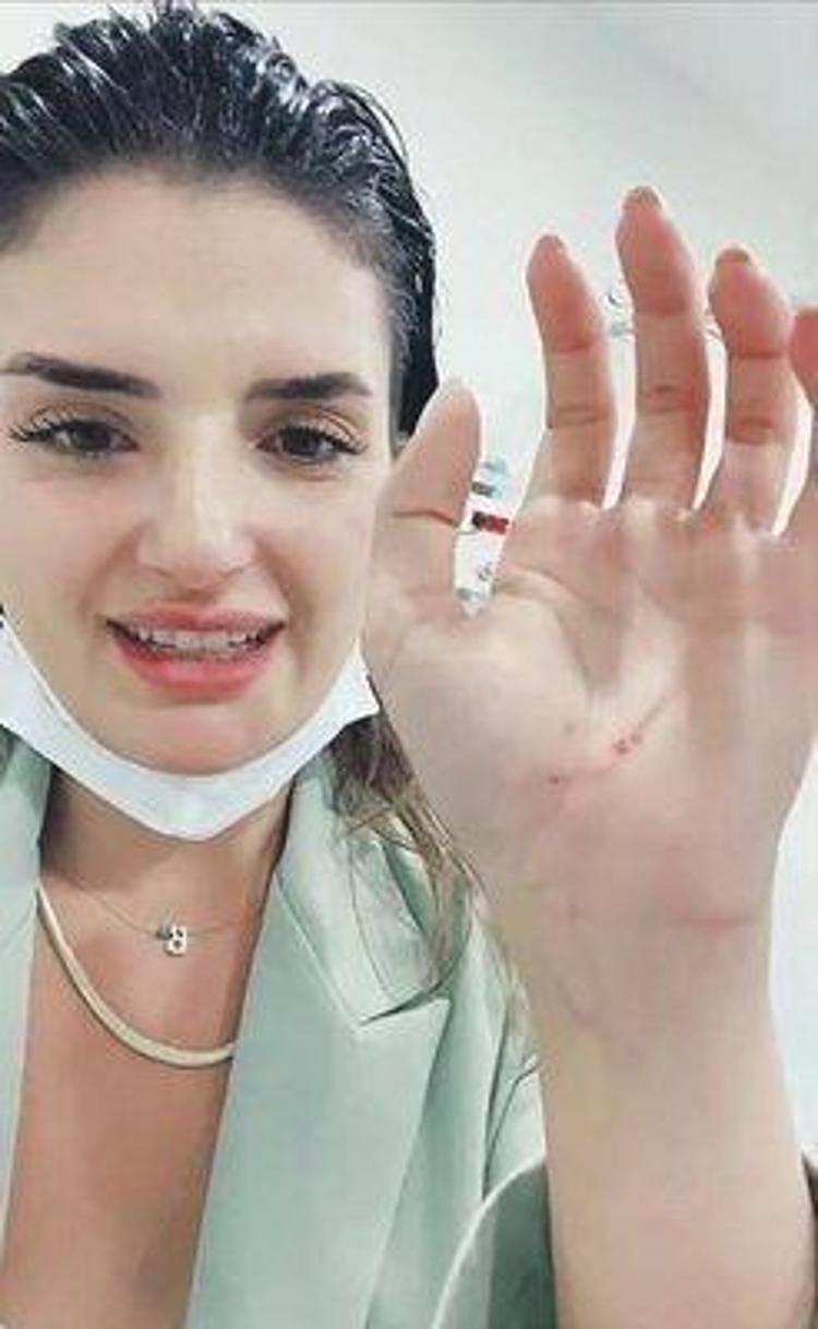 Şarkıcı Begüm Polat komşusunun saldırısına uğradı Tekme, tokat...