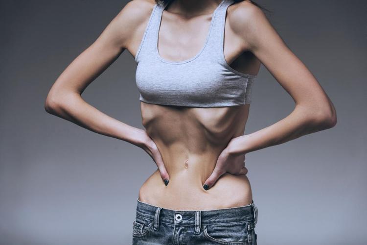 Ünlülerin hastalığı anoreksiya hipnozla tedavi edilebilir