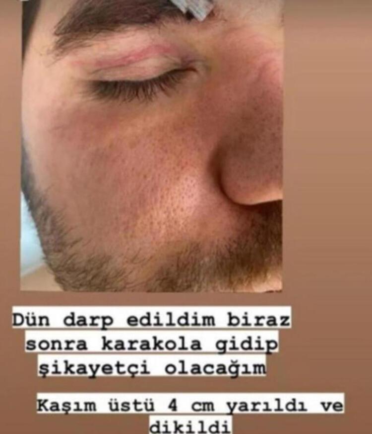 ÜZERİME ATLAYIP YUMRUKLAR SAVURDULAR