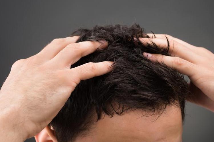 Kepek problemini tamamen yok ediyor Saçlarınızda çemen tohumu mucizesi