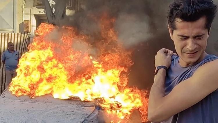 İsmail Hacıoğlunun yüzüne fünye patladı