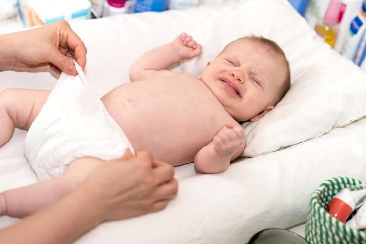 Bebek pişiğine ne iyi gelir, nasıl geçer Çocuktaki pişiğe iyi gelen şeyler