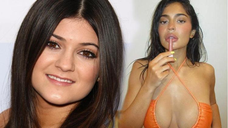 Kylie Jenner: Estetik yok, dolgu yaptırdım