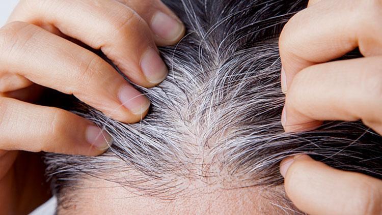 Genetik deyip geçiştirmeyin Saçlarınıza aklar düştüyse dikkat: Vücudunuz sinyal veriyor