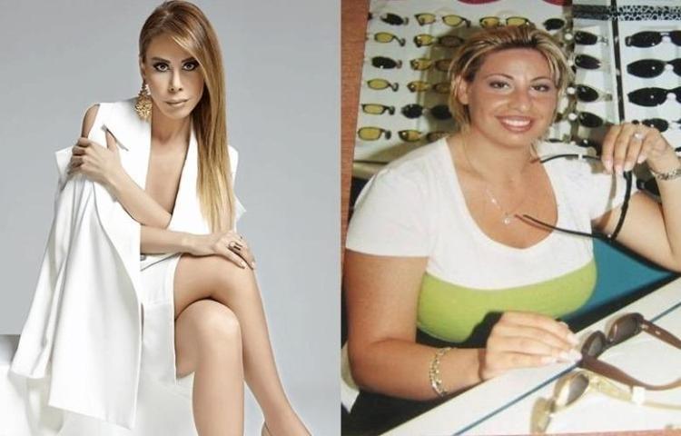 Bir ayda 17 kilo veren  Açelya Akkoyun bambaşka biri oldu İşte uyguladığı yöntem
