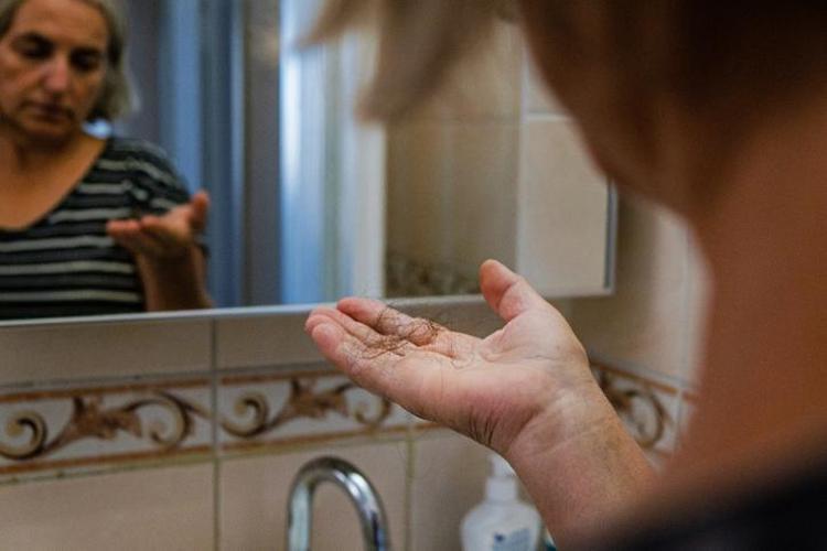 Kafasına sürenin 1 gecede saçı 3 kat çoğalıyor Evde hazırlanan 3 malzemeyle saç çoğaltıcı kür