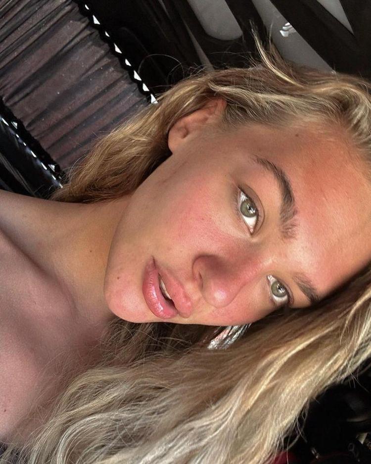 Melisa Döngel bakıma girdi