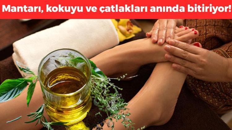 Ayağın altına sürünce doğal antibiyotik etkisi veriyor Mantarı, kokuyu ve çatlakları anında söküp atıyor