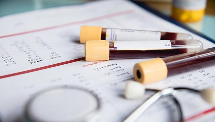 Kan vermek orucu bozar mı (Diyanet fetvası) Oruçlu iken kan vermek ve vücuda kan almak orucu bozar mı