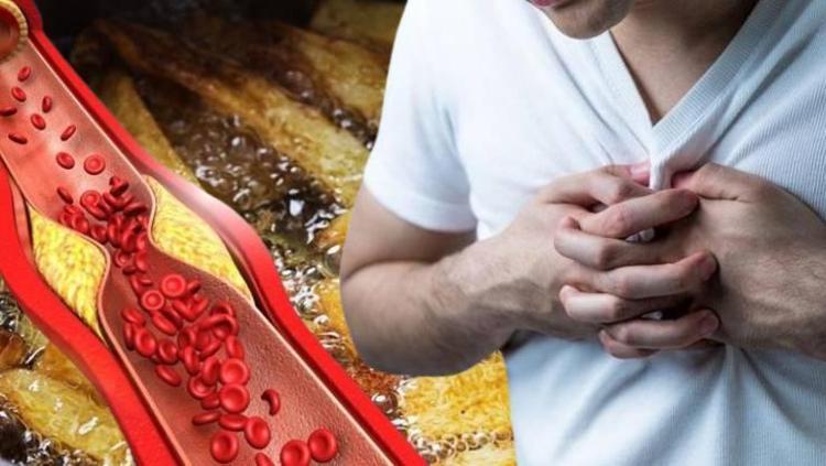 Kolestrolün baş sebebiymiş Sürekli olarak yiyorsanız dikkat: Kalp krizi ve felç riskini artırıyor