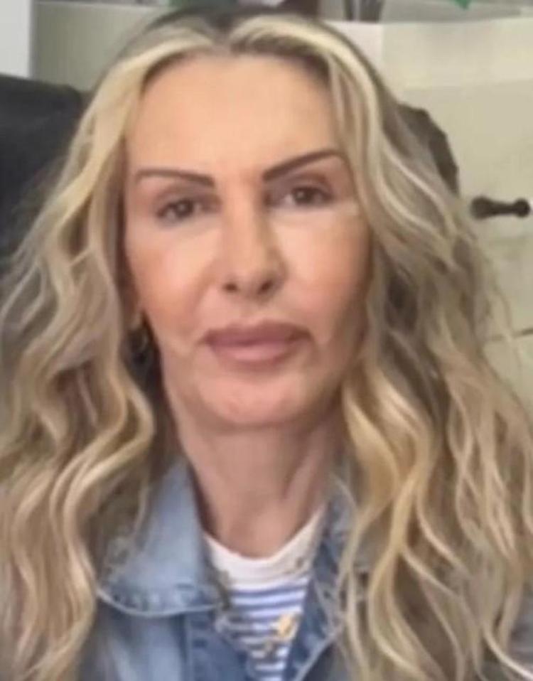 Estetik olmuştu Petek Dinçözün annesi Esra Süay Toğuşun son hali şaşırttı