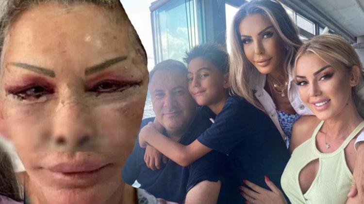 Estetik olmuştu Petek Dinçözün annesi Esra Süay Toğuşun son hali şaşırttı