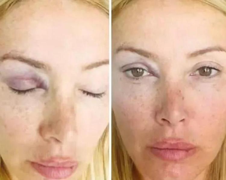 Şiddet gördüğünü açıklamıştı Evlenip Miamiye yerleşen Yeşim Erçetinin eşi hayatını kaybetti
