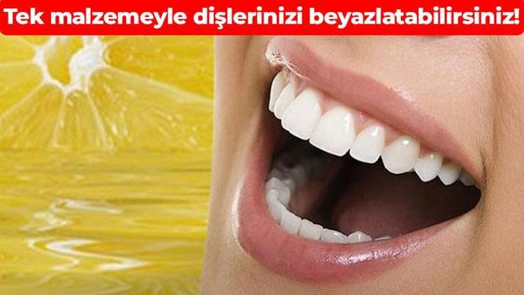 Tek yöntemle sararmış dişleriniz bembeyaz olacak Bembeyaz bir gülüş vadediyor: Evde diş beyazlatma nasıl yapılır
