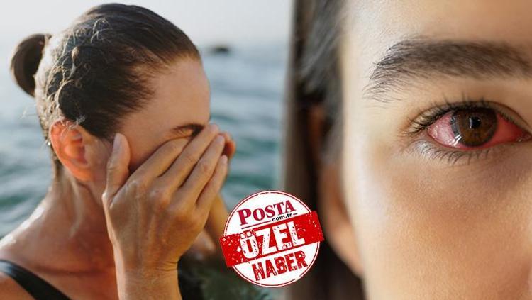 Havuza ve denize girerken dikkat Uzmanı uyardı: Ufak bir batmayla başlayıp kör ediyor