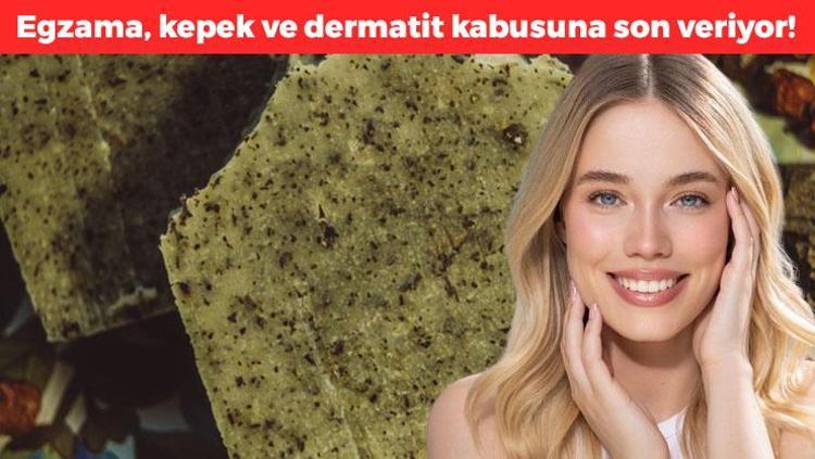 Egzama, kepek, dermatit ne varsa kökünü kazıyor Tanesi 30 TL: Tek gecede 10 yaş gençleştirip cildi ışıl ışıl yapıyor