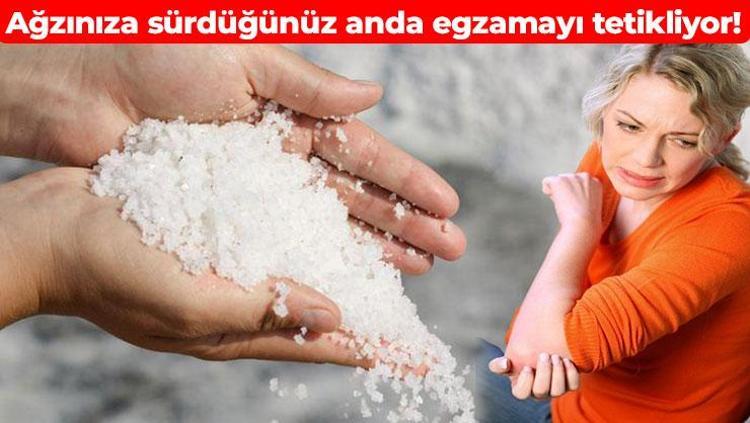 ABD’li bilim insanları korkunç gerçeği açığa çıkardı O besini yediğiniz anda egzamayı tetikliyor: Fazlası ciltte birikip iltihaplanmaya yol açıyor