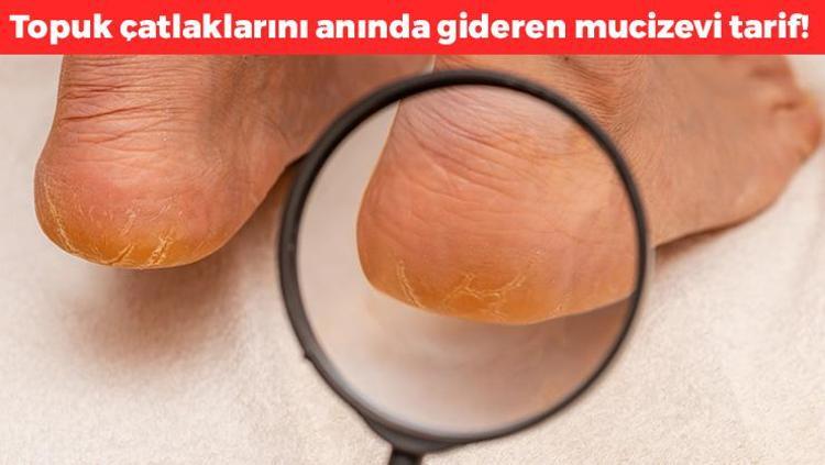 Gece yatmadan önce sürünce ayakları yumuşacık yapıyor Bakımlı ayaklar için 1 damla yetiyor, cildi pürüzsüzleştiriyor, topuk çatlaklarını anında geçiriyor