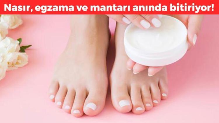 Mantarın kökünü kurutuyor Nasır, mantar ve egzamayı 1 gecede bitiriyor, doğal antibiyotik anında etki ediyor