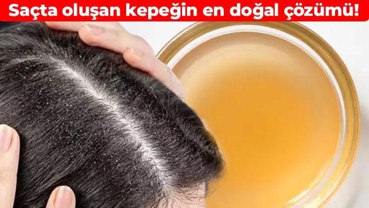 Saçtaki kepeği söküp atıyor Haftada 1 kez kullanmak yetiyor: Kökleri halat gibi güçlendiriyor, saçları güneş gibi parlatıyor