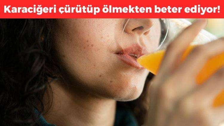 Bardak bardak içiyoruz ama karaciğeri çürütüyor Tokluk hissini yok edip kilo aldırıyor, ömürden 10 yıl çalıyor
