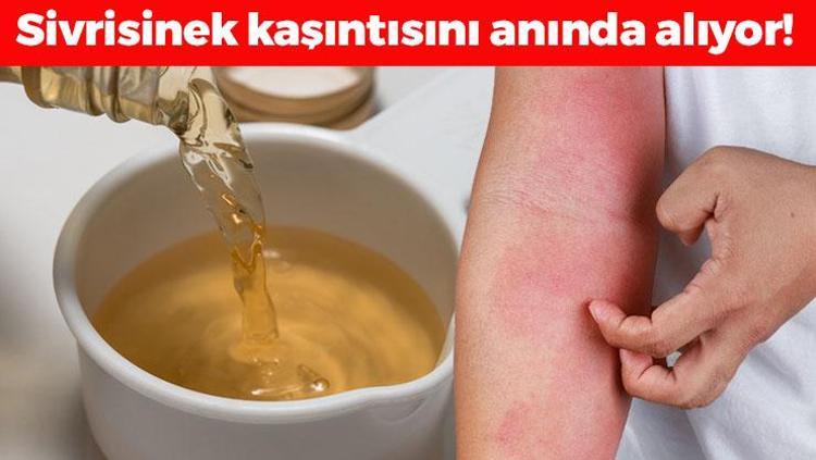 Sinek ısırığı kaşıntısını anında geçiriyor 1 damla sürmek yetiyor, cildi pamuk gibi yumuşatıp kızarıklığı ve şişliği silip atıyor