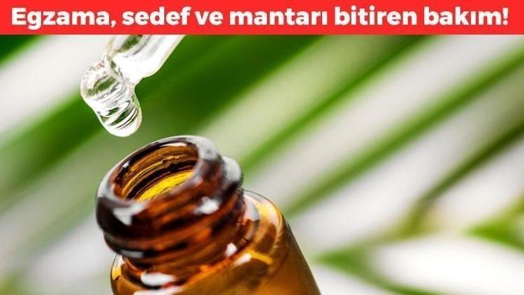 Doğal deodorant olarak da biliniyor Egzama, mantar ve sedefin kökünü kazıyor 1 damla sürmek bile yetiyor