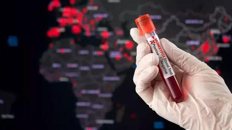 Maymun Çiçeği’nin anatomisi